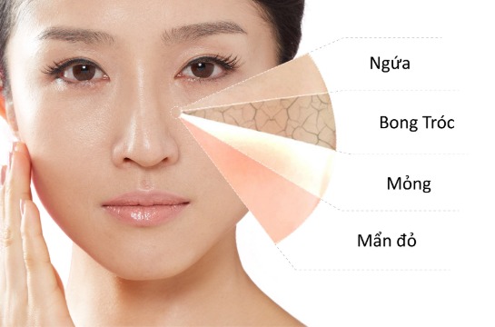 Chọn toner phù hợp với làn da của mình