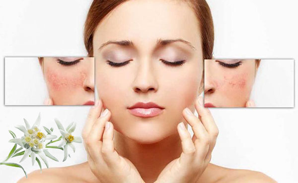 Ứng dụng chiết xuất hoa nhung trong mỹ phẩm