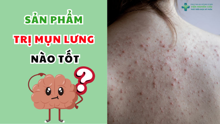 Sản phẩm trị mụn lưng – giải pháp toàn diện cho làn da tự tin