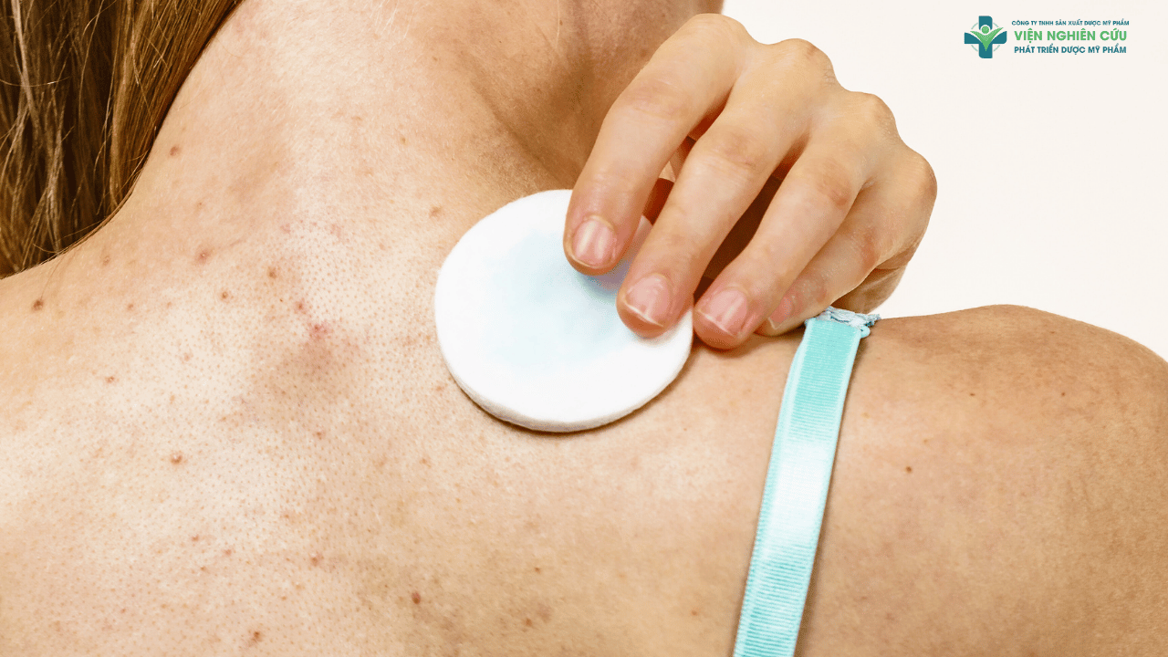 Vì sao thuốc trị mụn lưng cho nữ đặc biệt quan trọng?
