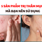 5 san pham tri tham mun ma ban nen su dung 85x85