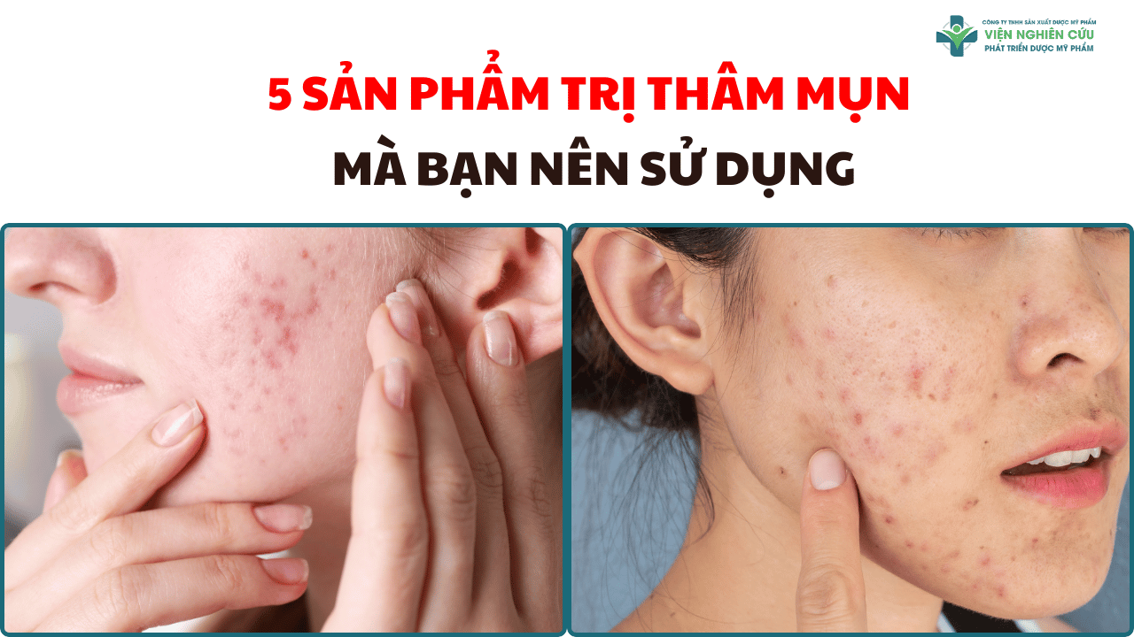 5 sản phẩm trị thâm mụn mà bạn nên sử dụng