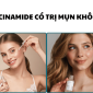 Niacinamide co tri mun khong_ Su that va cach dung hieu qua cho da mun 85x85