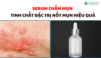 Serum chấm mụn – Tinh chất đặc trị nốt mụn hiệu quả
