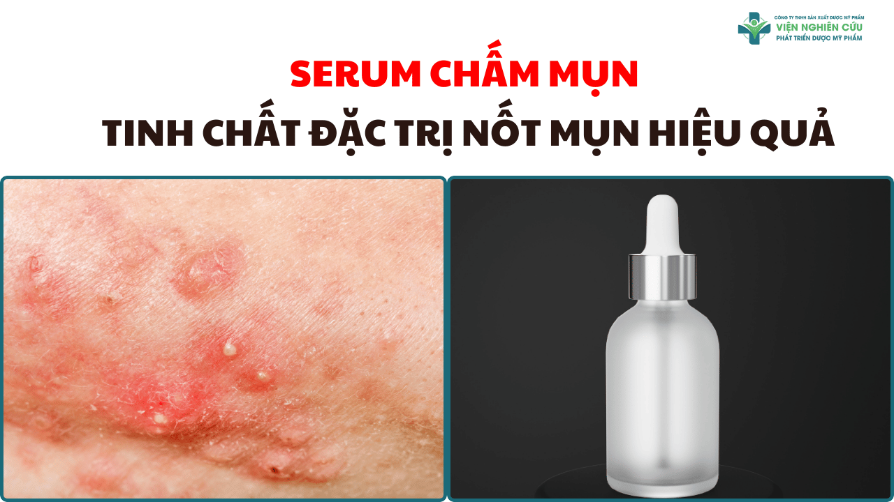 Serum chấm mụn – Tinh chất đặc trị nốt mụn hiệu quả